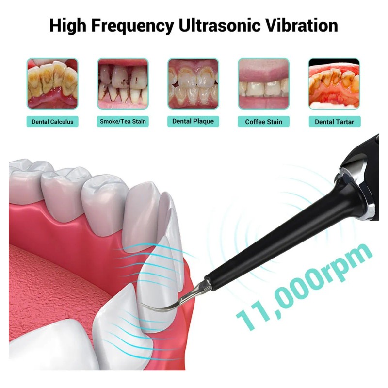 Cepillo Dental Electrico Cuidado Dientes Con Luz 3 Modo 6en1