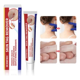 Crema Para Eliminación De Verrugas De Manos Y Pies Verrugas