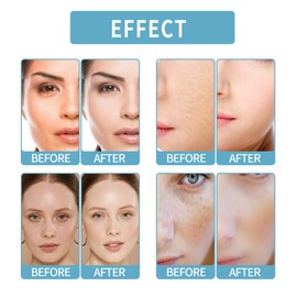 10ML Gla-Mory Micro Infosion Facial System,Hyaluronic Acid Serum,Gla-mory Micro System for Lips,Hyaluronic Acid Face Serum,Gla-mory Micro System for Face,Skincare Hydrating Serum,Face Serum for Women