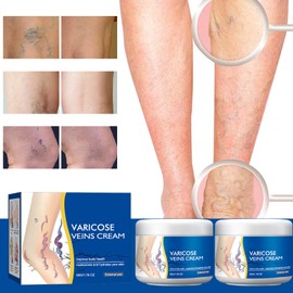 taduno Varicose Veins Cream for Legs, Gentle Soothing Skin Cream for Legs, Moisturizing Skin Care, 1.76 Oz (2PCS)