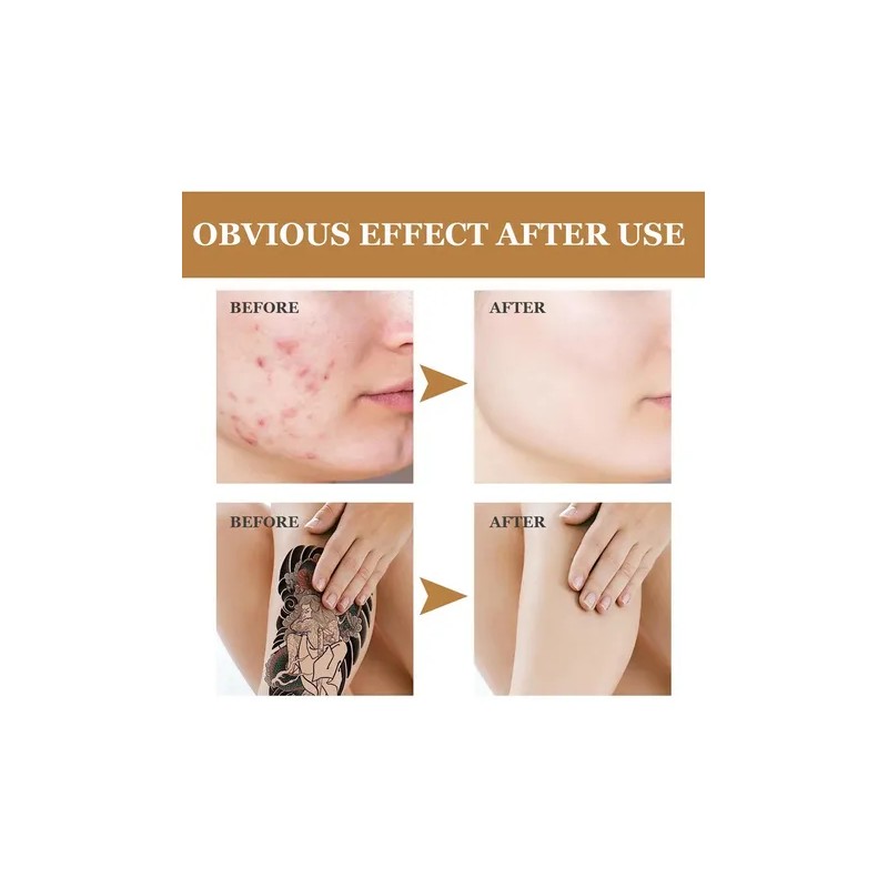 Corrector Impermeable Oculta Manchas Tattoo En La Piel Tono Carne