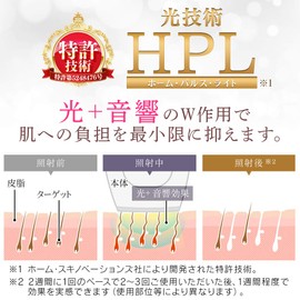 Iris Ohyama EP-0115-P Light Reducer, Epileta, Light Beauty Container, 150,000 Illumination, Full Body, 5 Adjustable Levels, Unisex, Gentle on Skin, Full Body Unwanted Hair Treatment