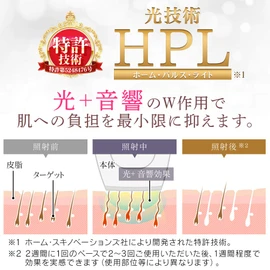 Iris Ohyama EP-0115-P Light Reducer, Epileta, Light Beauty Container, 150,000 Illumination, Full Body, 5 Adjustable Levels, Unisex, Gentle on Skin, Full Body Unwanted Hair Treatment