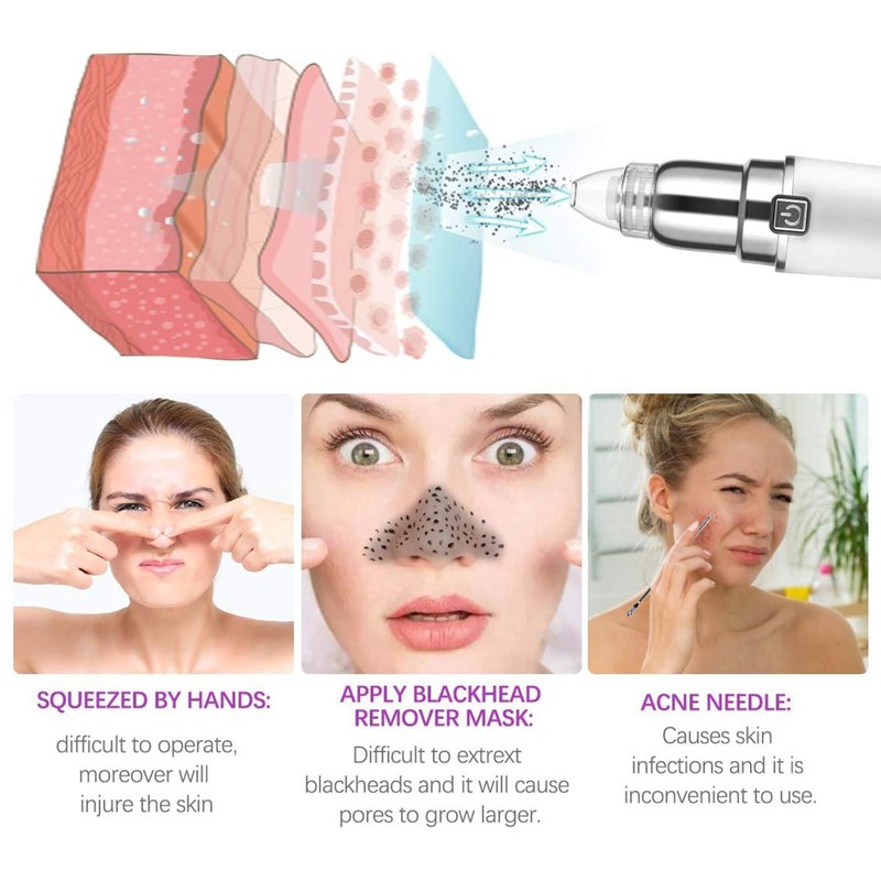 Blackhead Remover Vacuum 3 Suction Level Electric Pore Cleanser with