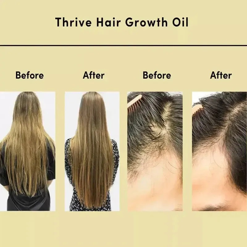 Aceite Vegano Natural Para El Crecimiento Del Cabello,60ml*3