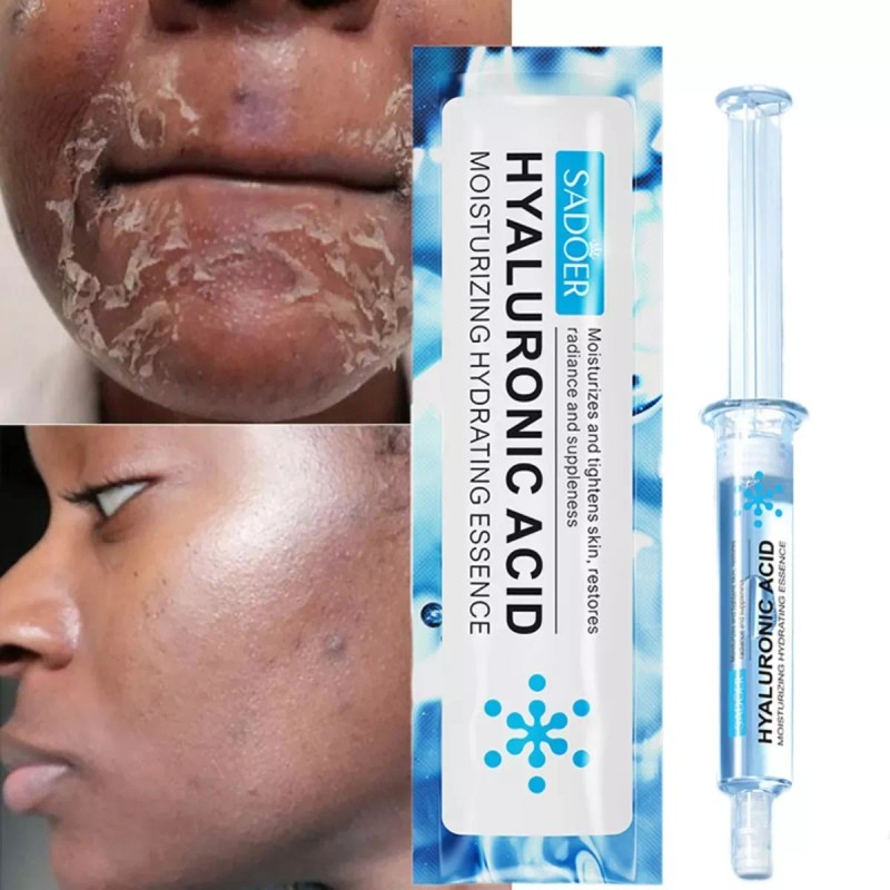 Universo en Linea Acido Hialuronico Facial, Antiedad, Manchas, Acne 5pzs