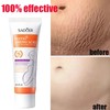 Pregnancy Stretch Mark Cream | OB-GYN Recommended Formula for Reducing