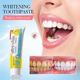 Staining toothpaste anti-gingivitis and antiplaque oral rinse (1, lemon)