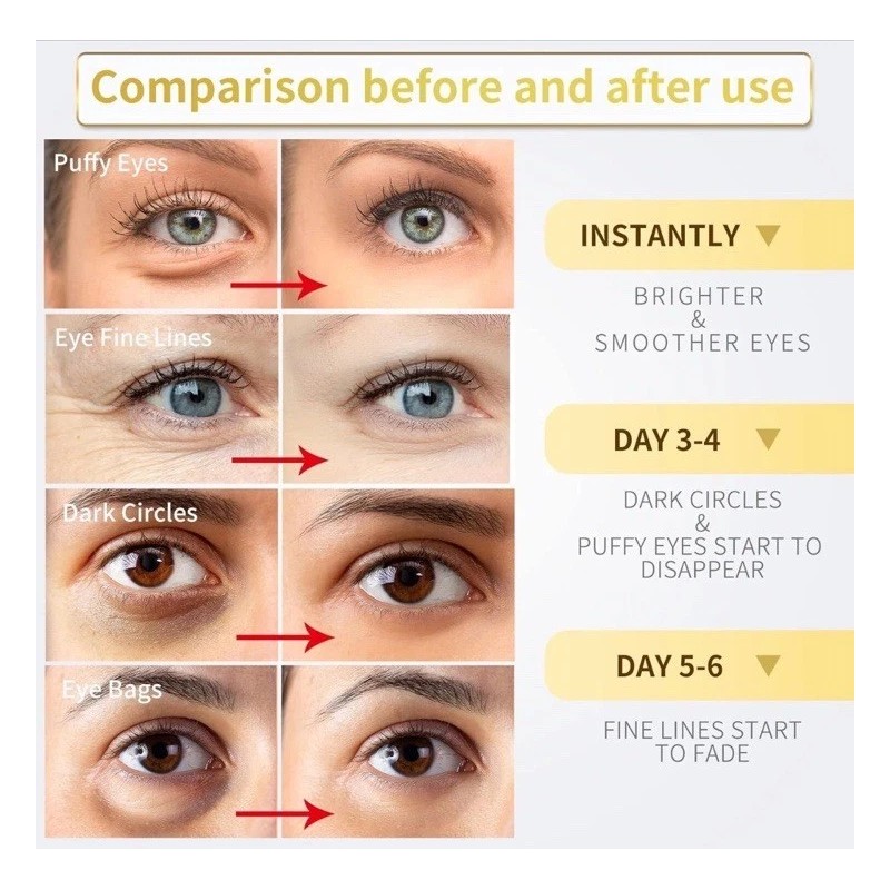 DERMORA 24K Gold Eye Mask, Puffy Eyes Dark Circle Under