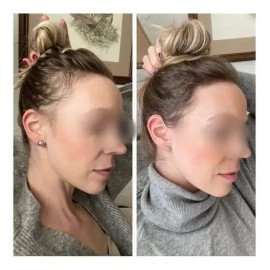 2pzs Shampoo Reviving Farmasipara Crecimiento De Cabello                                                                                              