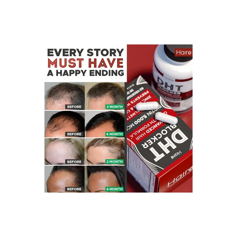 Bloquedor Dht 30 Capsulas Apoya El Crecimiento Del Cabello