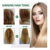 2025 . Productos Para El Cabello Loss Ouhoe Growth Prevent