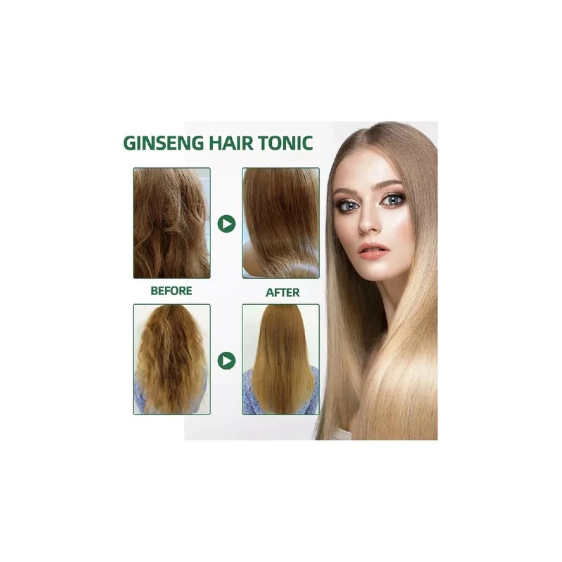 2025 . Productos Para El Cabello Loss Ouhoe Growth Prevent