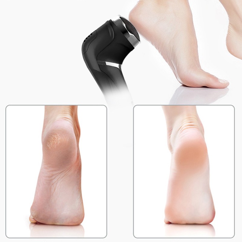 Electric Foot Callus Remover LCD Display Dead Skin Remover Foot