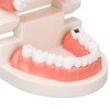 Dental Disease Caries Teeth Model Resin Simulation Teaching Prop Dental