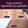 Mederma Hoja Silicona Grado Médico Cicatrices Pequeñas Pulgadas Unidades Lesiones