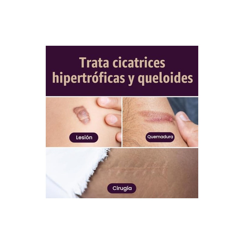 Mederma Hoja Silicona Grado Médico Cicatrices Pequeñas Pulgadas Unidades Lesiones