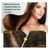 Champú Loss Helps Hair Growth Balm Hair Nettle Shampoo 30