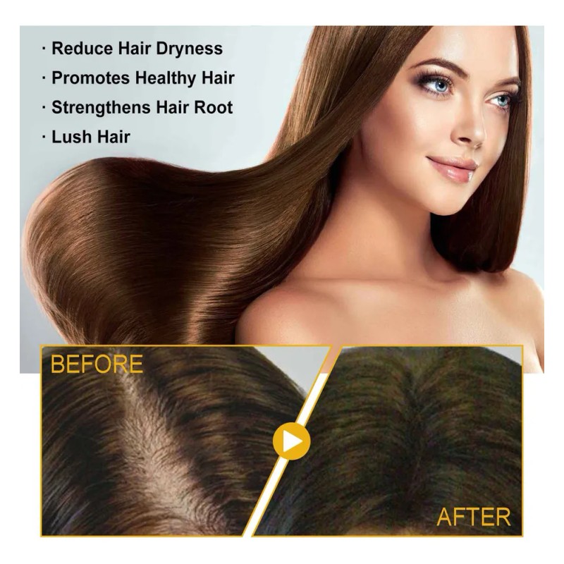 Champú Loss Helps Hair Growth Balm Hair Nettle Shampoo 30
