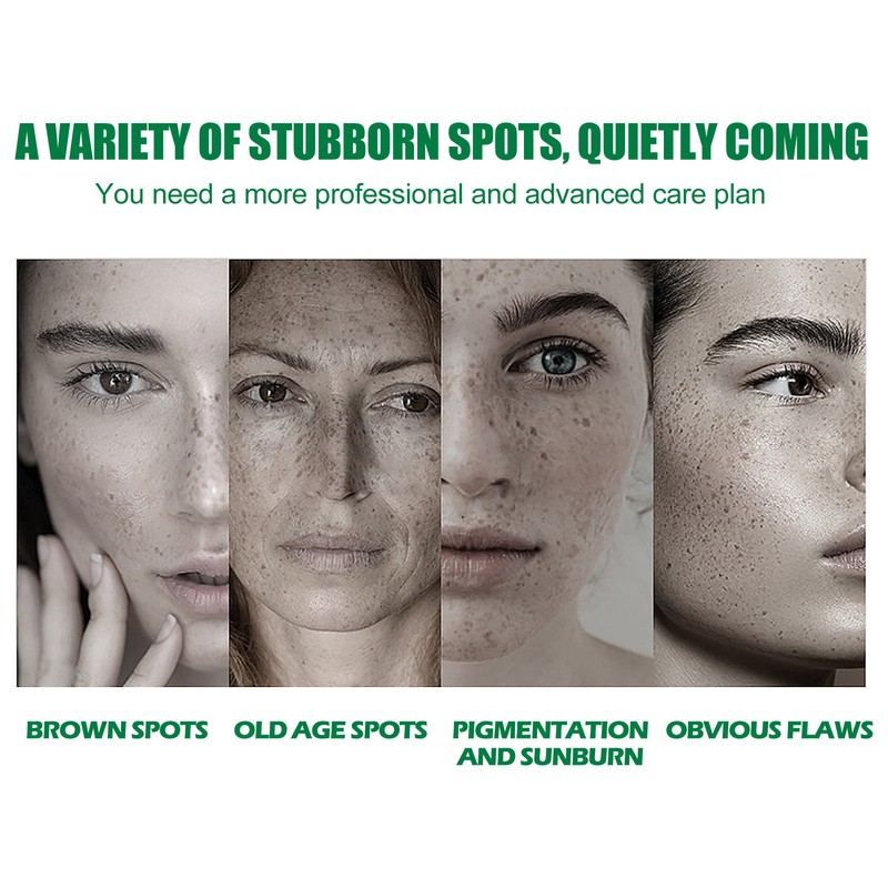 South Moon Eelhoe Dark Spot Correcting Glow Serum Whitening Freckle