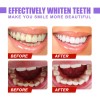 Sss Eelhoe V34 Pasta De Dientes De Reparación De Dientes