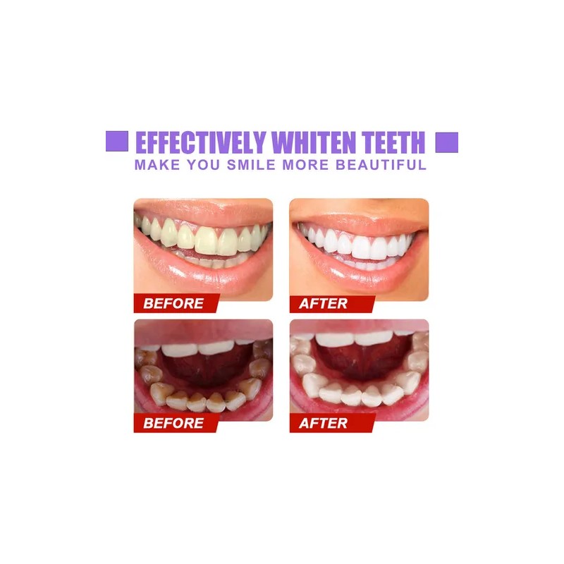 Sss Eelhoe V34 Pasta De Dientes De Reparación De Dientes