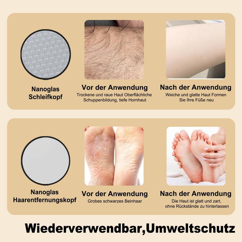 Hornhautentferner Elektrisch mit DermaGlide Technologie - Wiederaufladbar & mit 4