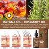 Batana Oil Hair Growth Serum with Rosemary, Scalp Detox Treatment,