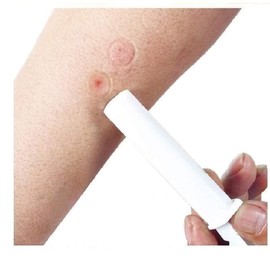 Finever Mosquito Bee Bug Sting Bite Kit Suction Tool Safety First Aid Supplies Tool for Hiking Backpacking Camping