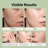 Gel Exfoliante Facial Té Verde Triple Enzima Peeling Suave Rostro