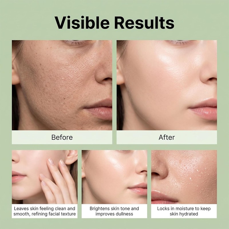 Gel Exfoliante Facial Té Verde Triple Enzima Peeling Suave Rostro