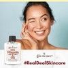 COCOCARE 100% Vitamin E Oil, 14000 I.U., 0.5 Fl Oz