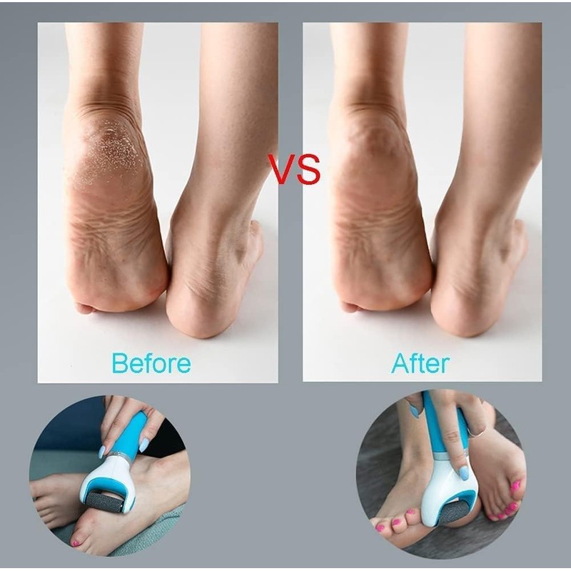 5 x Replacement Rolls for Velvet Express Pedi Refill Rolls,