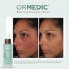IMAGE Skincare ORMEDIC Balancing Antioxidant Serum 1oz.