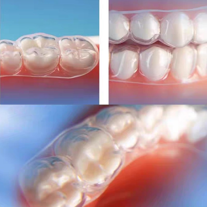 Custom Clear Retainer, Dental Retainer for Adults & Teens, Slim,