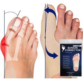 Bunion Bootie - Bunion Corrector for Big Toe - Bunion Socks for Active Adults - Bunions Correction Splint - Bunion Sleeve for Hallux Valgus Correction (Small-Right)