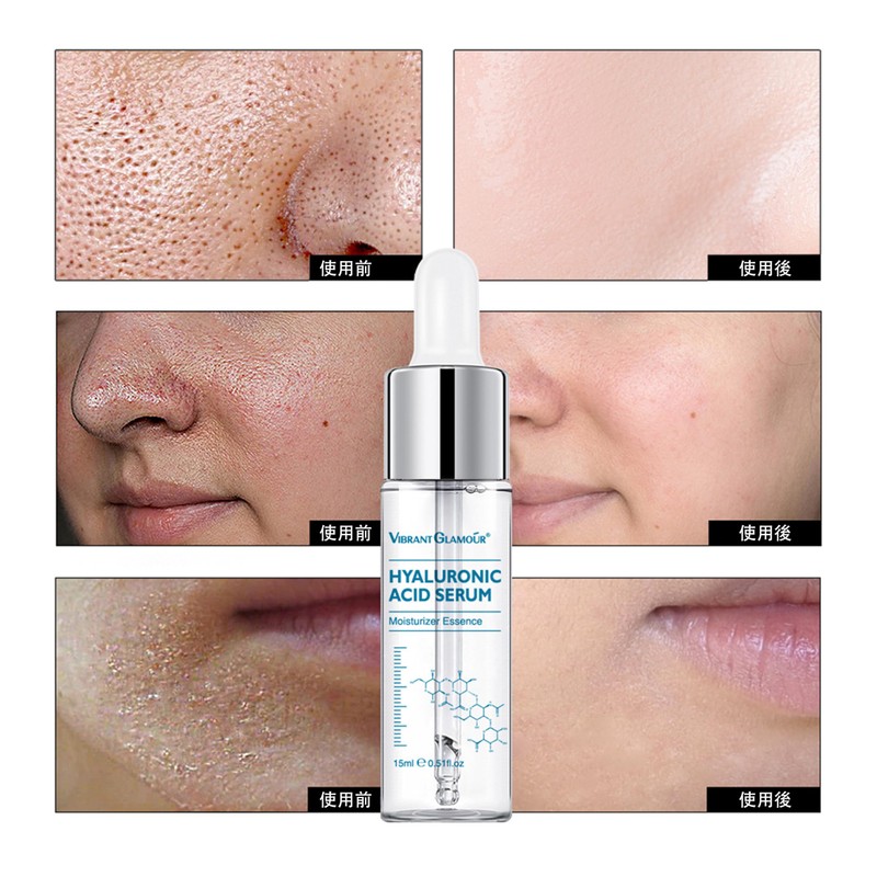 Hyaluronic Acid Solution 0.5 fl oz (15 ml) Additive-Free Mixing