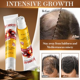 Batana Scalp Soothing Dense Hair Conditioning Roller Balls – 2 Stück – Organische Haaröl Für Schnelleres Haarwachstum, Stärkere Wurzeln & Weniger Haarausfall – Für Alle Haartypen – Pflegendes Haaröl