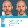 Maruderm Hyaluronic Acid Moisturizing Face and Body Skin Care Cream