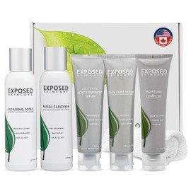 Exposed Skin Care Expanded Acne Treatment Kit - Includes Salicylic Acid Face Wash, Clearing Tonic, Treatment Serum with Benzoyl Peroxide, Clear Pore Serum, Moisture Complex - Made for All Skin Types