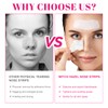 Blackhead Remover Nose Pore Strips for Deep Cleansing, Nose Pore