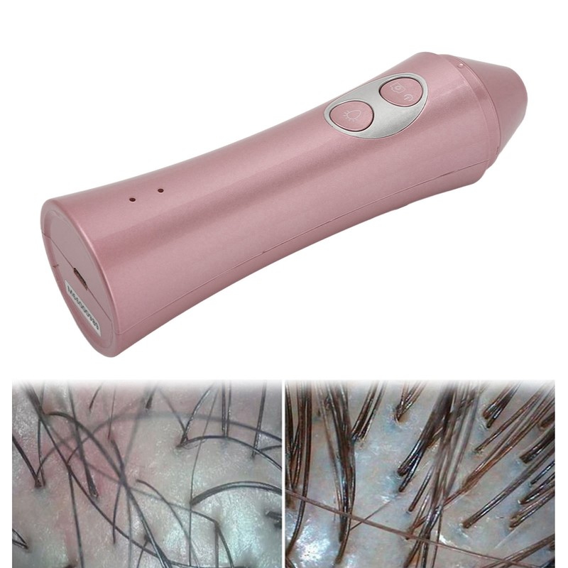 3MP 50X Scalp Detector Portable Handheld Skin Hair Ultraviolet Analyser