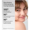 AZEANE ACIDO AZELAICO 15% CREMA 30ML, (ACM)