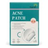Parches Antiacné Absorben Grasa Espinillas Granitos 72 Pz