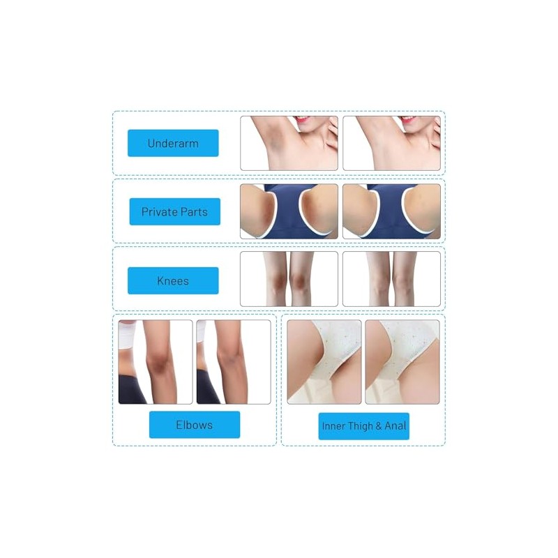 Crema Gel Aclaradora Zona Íntima Corporal Niacinamida Arbutina Vitamina Zonas