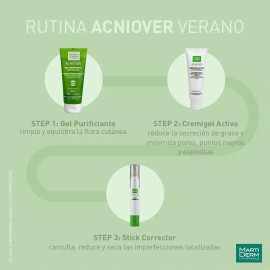 Martiderm Acniover Gel Limpieza Facial Purificante - 200 Ml Tipo de piel Mixta