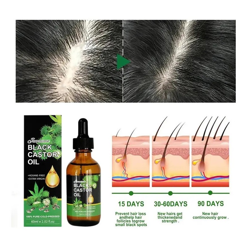 Aceite De Ricino,crecimiento De Pestañas, Cejas, Cabello 2pc