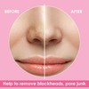 JOLVKA Blackhead Remover Pore Strips for Nose - 65 Strips