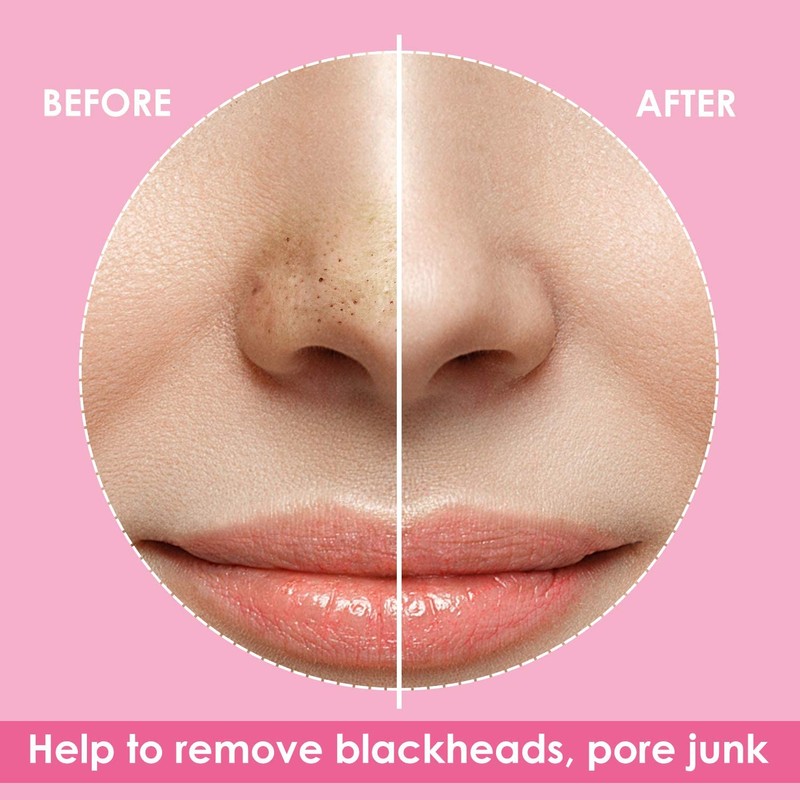 JOLVKA Blackhead Remover Pore Strips for Nose - 65 Strips