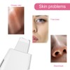 Household Ultrasonic Skin Scrubber EMS MicroCurrent Blackhead Removal Face Pore